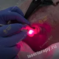 Лечение рака может быть таким? Да. Лечение рака может быть таким? Да.