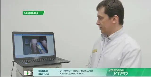 Меланома 4 стадии с метастазами. Уникальная технология лечения меланомы методом ФДТ.