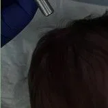 В Клинике ФДТ проводится удаление гигантских невусов, а также лечение рака кожи, базалиомы, первичной меланомы кожи, дисплазии шейки матки.