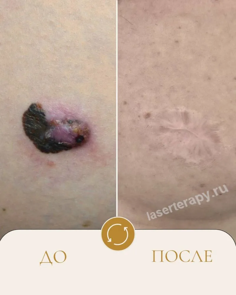 История нашего пациента  начиналась по привычному сценарию, который повторяется уже много лет.