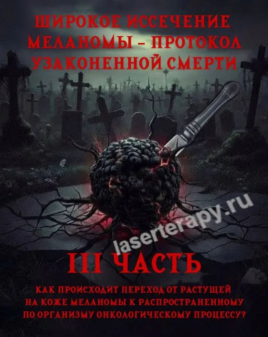 Широкое иссечение меланомы - протокол узаконенной смерти 3