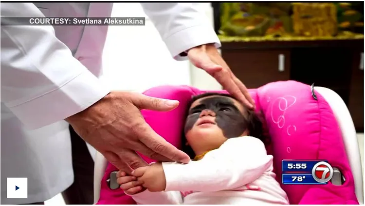 Something to Smile About: South Florida toddler treated in Russia to remove dangerous birthmark